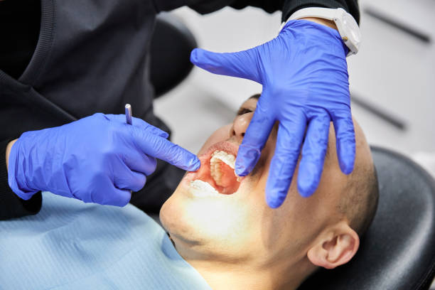 Best Emergency Dentist for Lost Fillings or Crowns in Orleans, VT